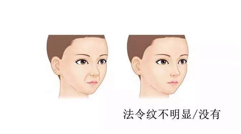 外傷紋 面相|【面相】臉上最重要的幾條紋（一）